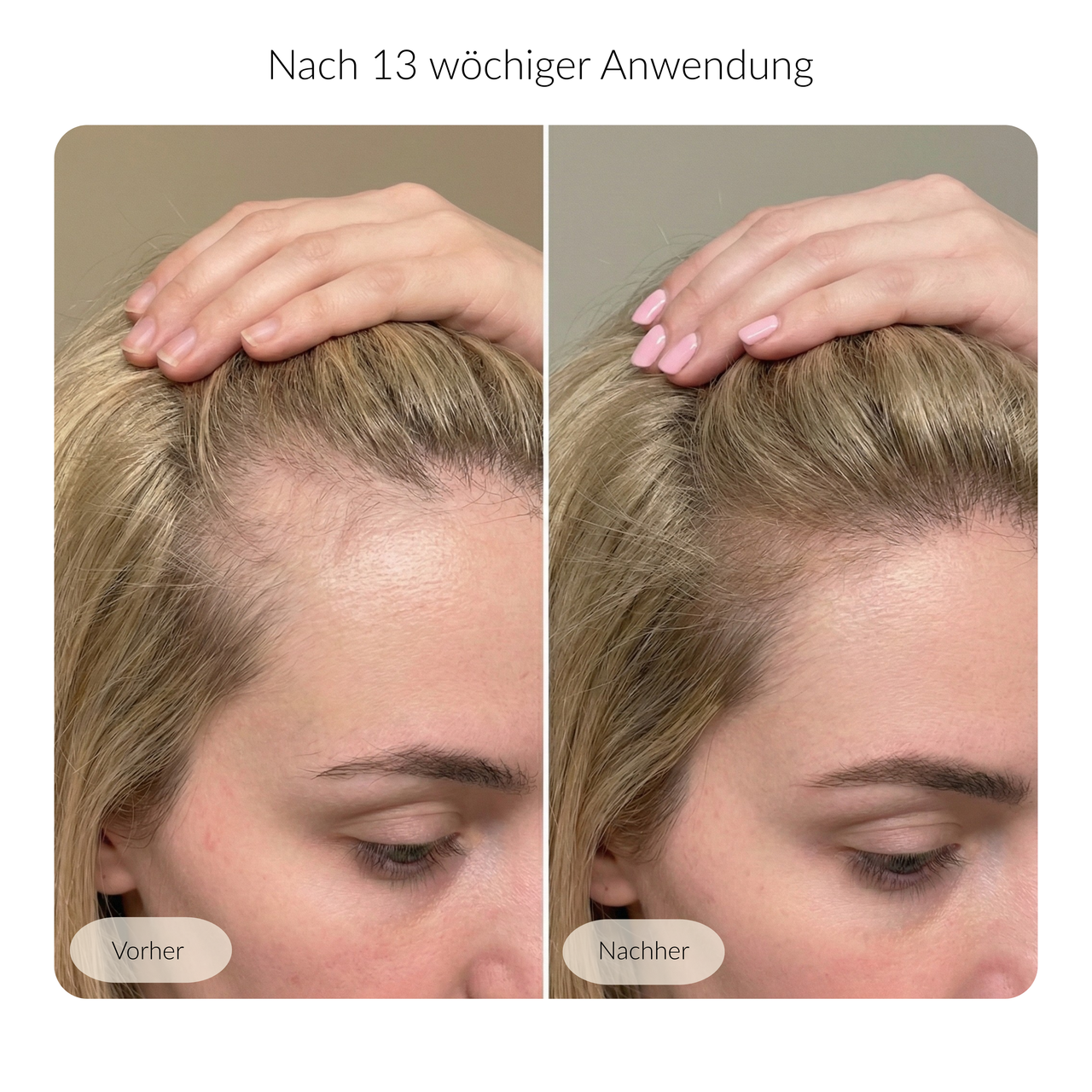 Harvekst – Hair Serum